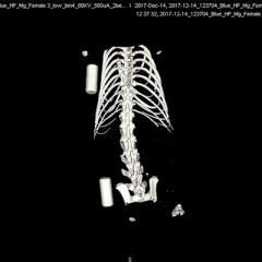 xray 3d view
